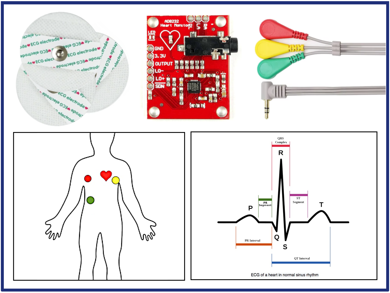 ECG operation.png