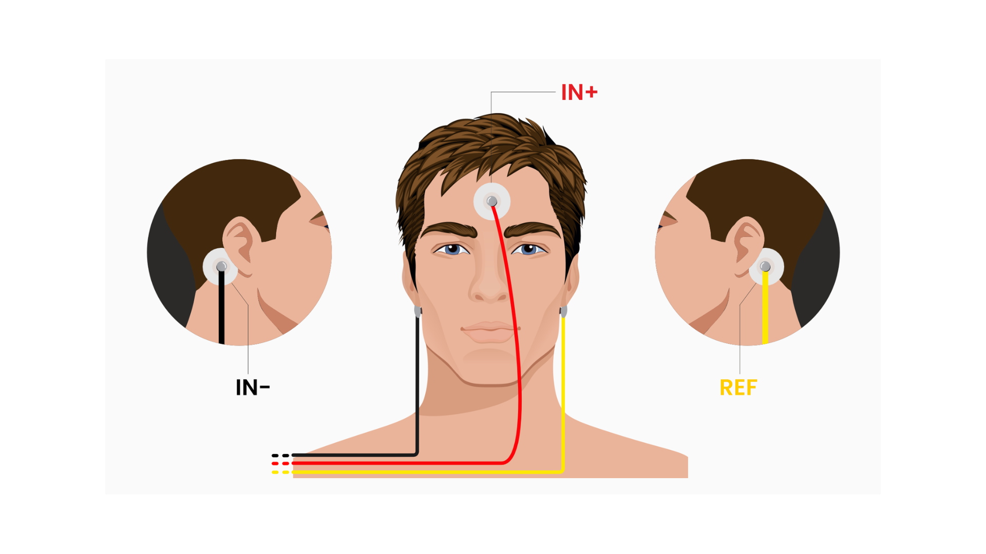 Step 1.png