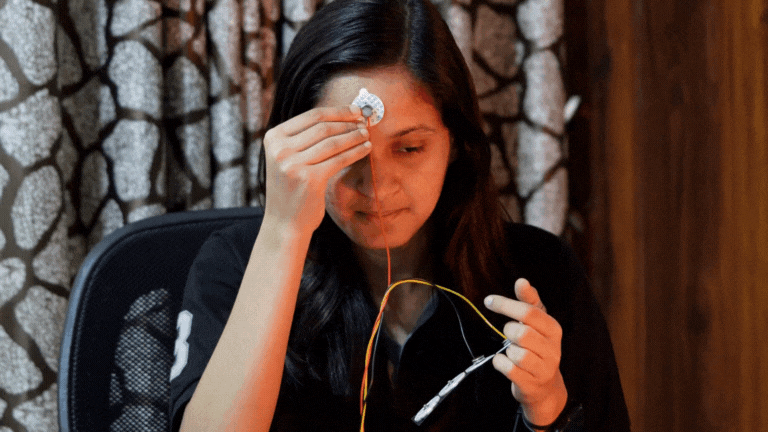 electrode placement.gif