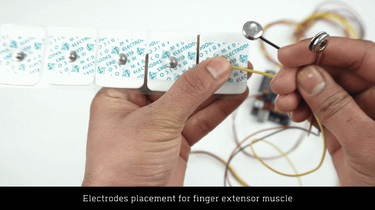 electrode-placement-ch1.gif