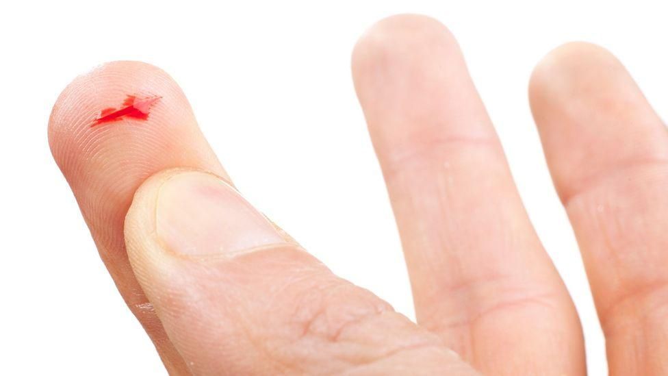 Chap Stick Heals Paper Cuts 