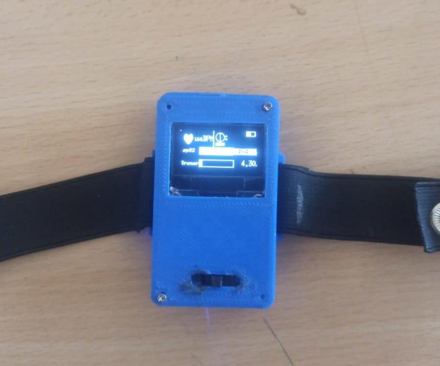 MediPulse-Wearable Device for Real-Time Monitoring of Parkinson's Disease