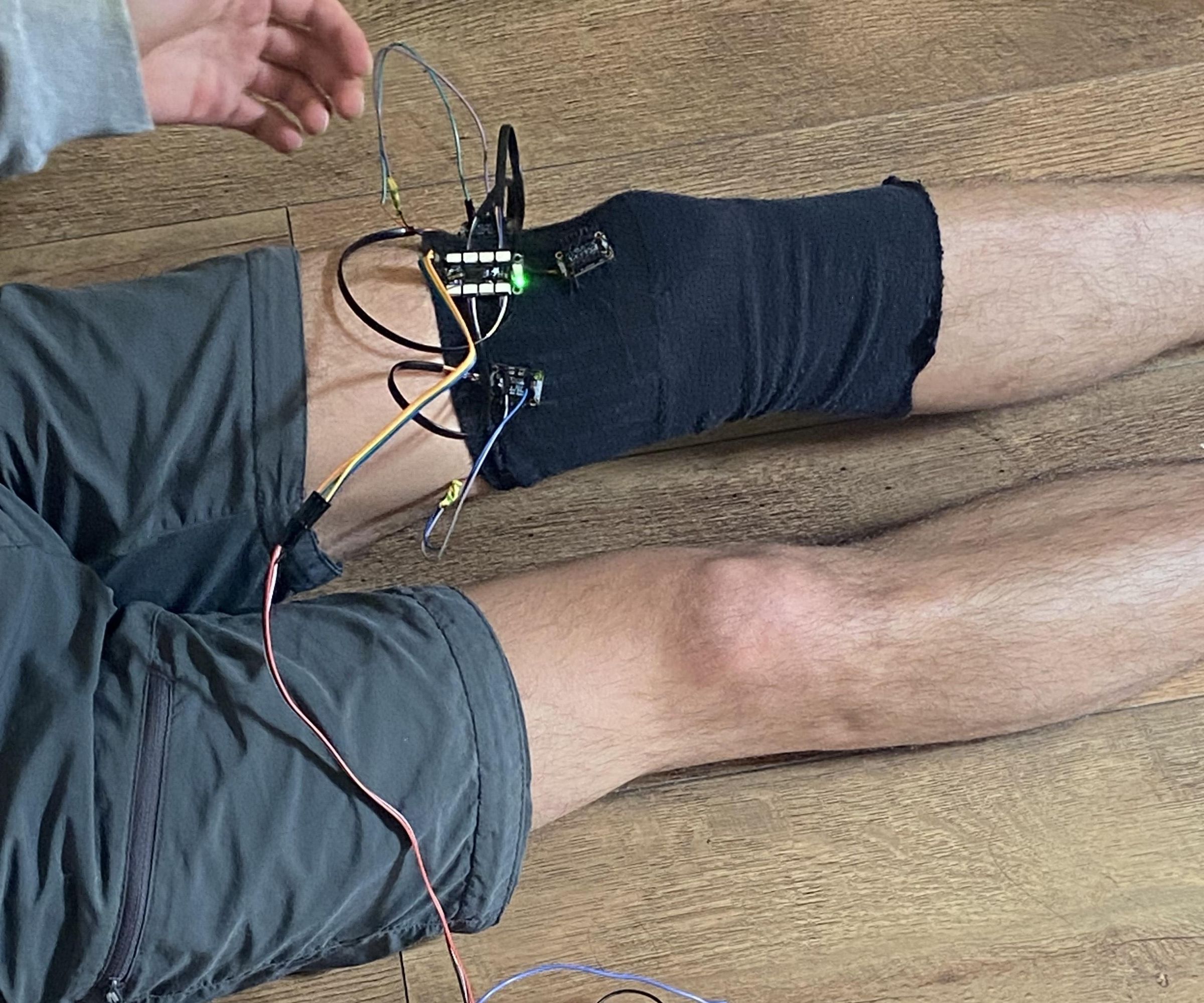 Haptic Feedback Motion Correction Rehabilitation Device