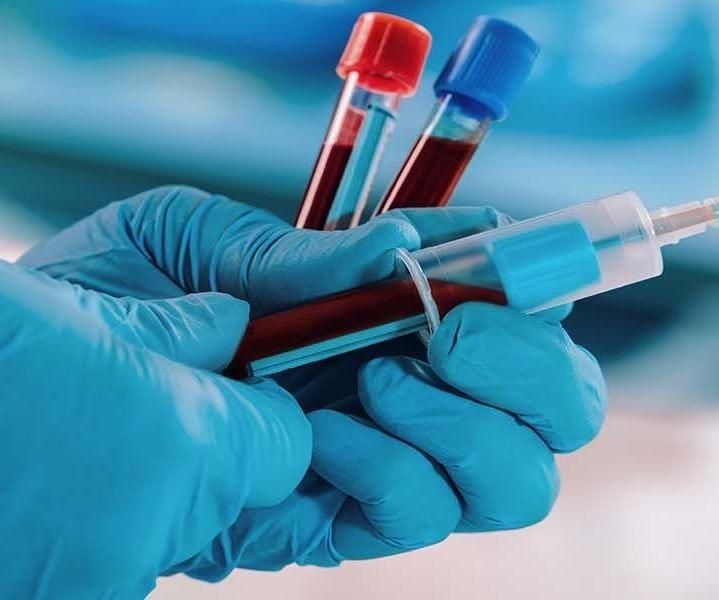 How to Perform Venipuncture (Laboratory Blood Testing)