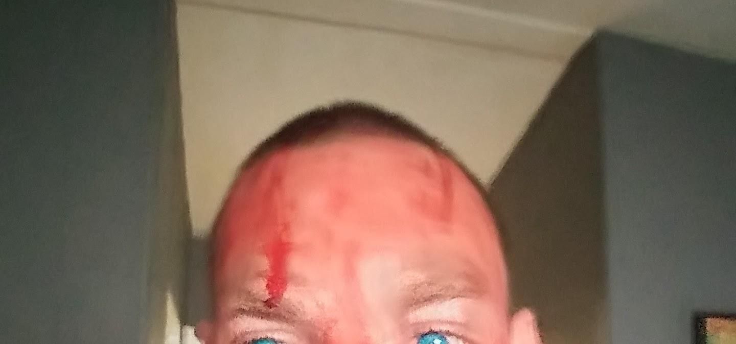 Mouth Stitched Shut