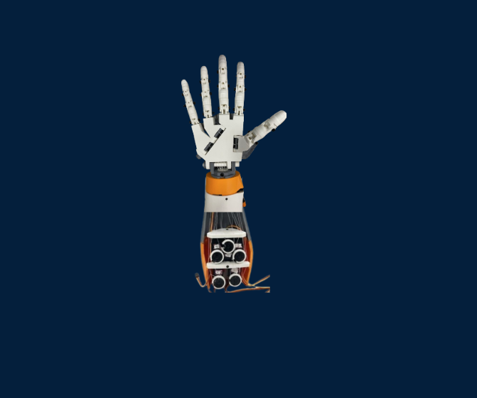 3D Printed Prosthetic Arm
